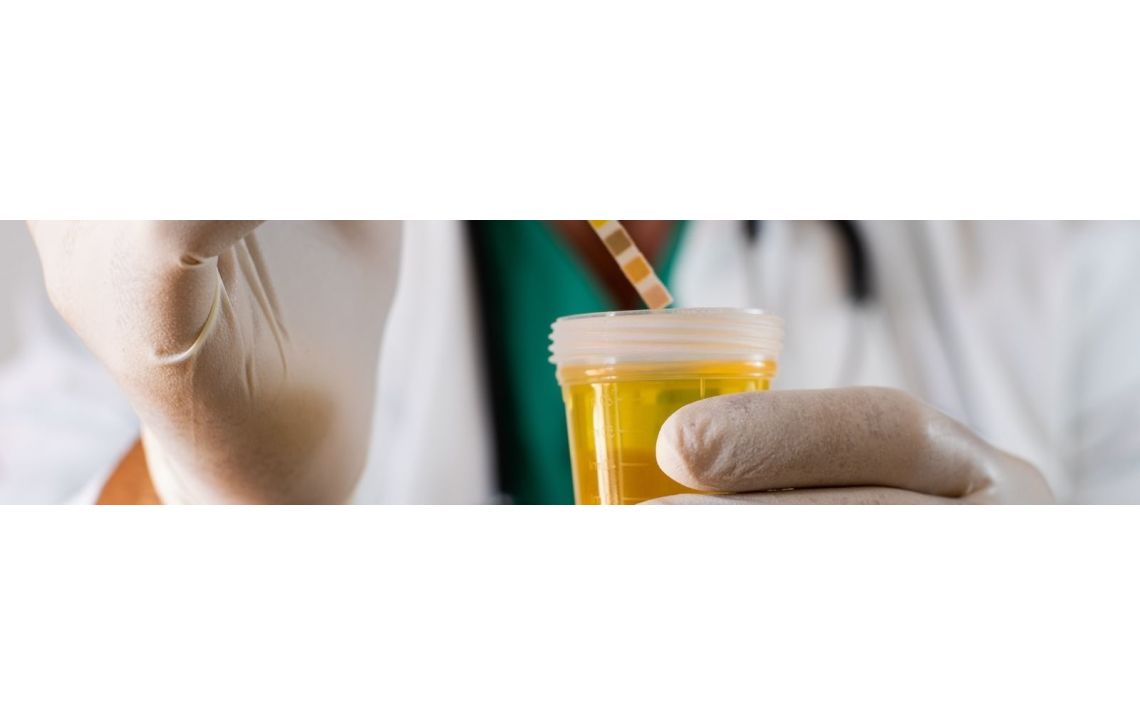 Infections urinaires : tests en pharmacie